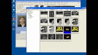 CBCT Integration to Carestream & J. Morita in TDO Software