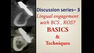 Resorbed distal mandible - Planning for basal implants - Lecture by Dr.C.Murugavel