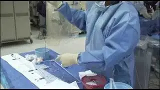 Peripheral Arterial Disease (PAD) Surgery