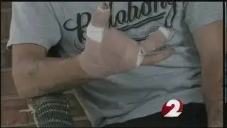 Local man loses fingers to fireworks