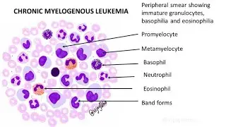 CML 1