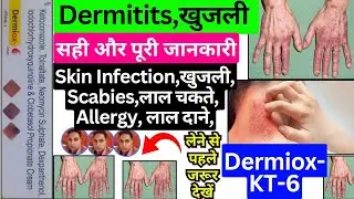dermiox kt 6 | ursderm kt 6 | dermitor kt 6 | derma kt | derma kt skin cream | derma kt nf cream |