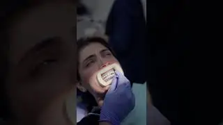 Best Laser Teeth Whitening Procedure in Lahore | Scaling and Polishing | Dental Clinic in Pakistan