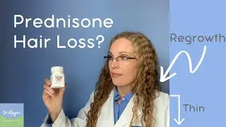 Prednisone Hair Loss? 👱&zwj;♀️ to 👩&zwj;🦲 (Side Effect)