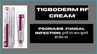Tigboderm rf cream uses in hindi by DRx Ronak choudhary #medicine #pharma #knowledge #tigbodermrf