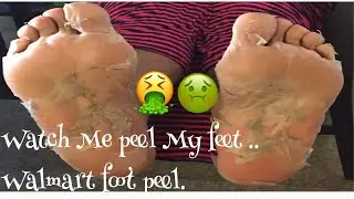 Watch me peel my feet .. I purchased a foot peel from Walmart...