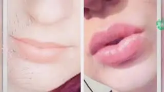 BEFORE AND AFTER RESULT OF USING CANDYLIPZ