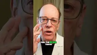 Reasons to NOT Get Sculptra
