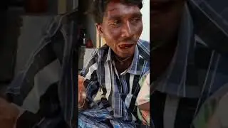 Strongest animal bite in the world? 🤯 | #shorts