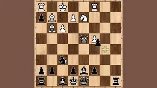 Chess | Human VS Computer Chess  | #chess #chessgame