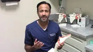 Knee Replacement Surgery