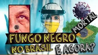 FUNGO NEGRO no BRASIL? Devo me preocupar? (MUCORMICOSE)