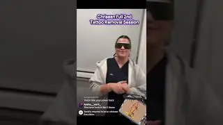 Chrisean Full Session Blueface Tattoo Removal.