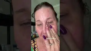 If you have dry/flaky skin