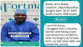 Real Results, Real Stories #hairtransplant Journey|| Fortmax clinics Jaipur #haircare #hair #doctor