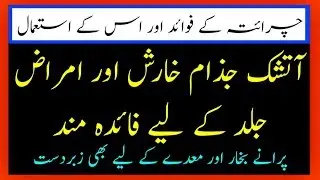 Charaita ke fawaid Aur us ke istemal