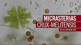 Micrasterias crux-melitensis | by Motic Europe