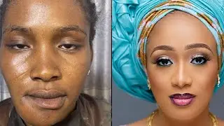 MUST WATCH👉🏽😱BRIDAL GELE AND MAKEUP TRANSFORMATION🔥 CIRURGIA PLASTICA 💉💉😳🔥😱 MAKEUP TUTORIAL