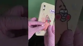 The best pimple popping video you&rsquo;ve ever seen👌🏻 #satisfying