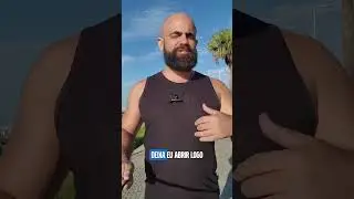 O dia em que parei de ter medo de ficar careca