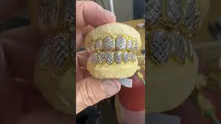Grillzstation - Custom Gold Grillz #goldgrillz #jewelry