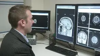 WNY soccer star will donate her brain to concussion research, study underway at UB