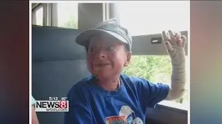 Dream comes true for teenager with rare skin disease
