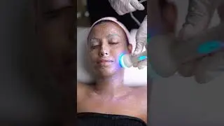 Transform your skincare routine with hydrafacial. #SkinRevolution