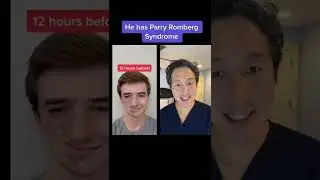 Plastic Surgeon Reacts to Jaw Surgery Countdown! #shorts #jawsurgery