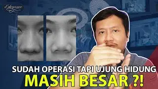 OPERASI MERAMPINGKAN TIP HIDUNG DI JAKARTA