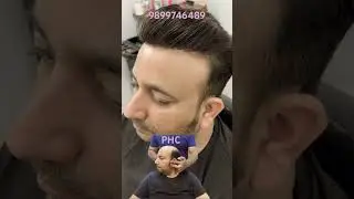 Skin Base Hair Patch System | 100% Natural Look #hairrestoration #hairsystem