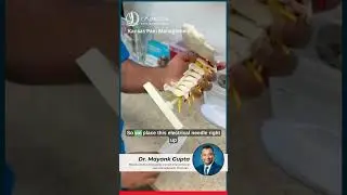 Найдите облегчение от боли в шее с помощью РЧА третьего затылочного нерва