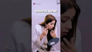Stress Acne? Here&rsquo;s Why It Happens & How to Treat It! | Dr. Vandana Malik #acne #skincare