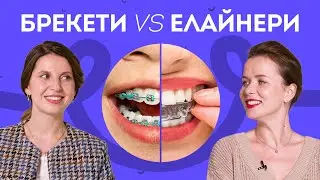 Брекети чи Елайнери, що краще? | Stoma Talk