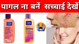 clean and clear face wash honest review,clean and clear face wash 2025,best face wash