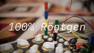 100%Röntgen