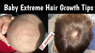 How To Grow Baby Hair Faster | Baby Extreme Hair Growth Tips | Babies Thick Hairs  | Paktolish