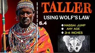 Increase Height At Any Age( Using Wolf's Law)!