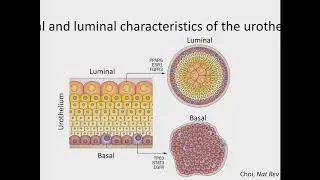Muscle-invasive Bladder Cancer - Roland Seiler MD FEBU