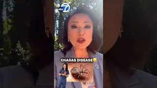 Смертельный паразит в Лос-Анджелесе! Реакция врача. Болезнь Шагаса #здоровье #Лос-Анджелес