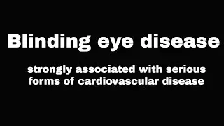 Blinding eye disease strongly associated with serious forms of cardiovascular disease