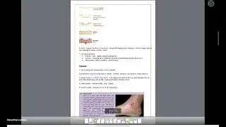 Cellulitis, lymphoedema, Ulcers,Varicose veins Surgery Short Case and Kuppi Presentation