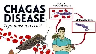 Don't Let the Kissing Bug Bite! Understanding Chagas Disease - Parasitology Animated Medical Lecture