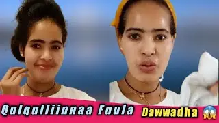 Bareeddinaa fuula keenya haala salphaadha akkatti eganuu.❤👌🏾