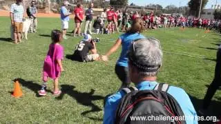 Ossur/CAF2016 MOBILITY CLINIC