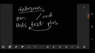 Otolaryngology - ENT - Vestibular neuronitis
