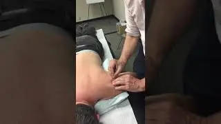 SI 10 Orthopedic Needling Demo by David Legge - Acupuncture Online CEU