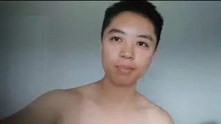 FTM Top Surgery Complication 3 Weeks Post-Op