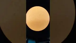 Microscopic image of urine routine 🔬🔬🔬🔬#subscribe #viral #tranding #microscope #urine_infection