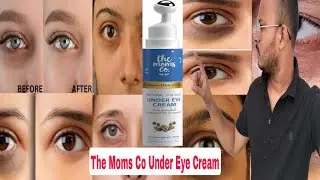 The Moms Co Under Eye Cream Review In Hindi